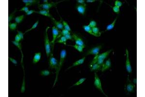 Immunofluorescence staining of Hela cells with ABIN7143093 at 1:100, counter-stained with DAPI. (ARPC4 anticorps  (AA 2-168))