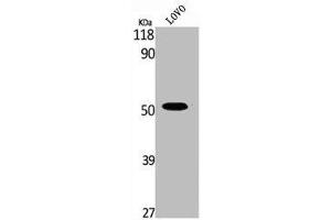 Western Blot analysis of LOVO cells using Phospho-MOR-1 (S375) Polyclonal Antibody (Mu Opioid Receptor 1 anticorps  (pSer375))