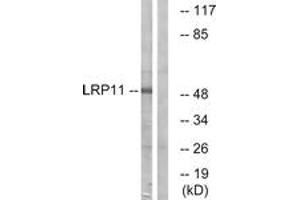 Western blot analysis of extracts from Jurkat cells, using LRP11 Antibody. (LRP11 anticorps  (AA 48-97))