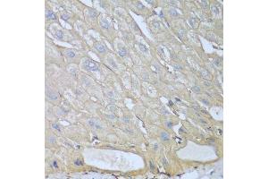 Immunohistochemistry of paraffin-embedded human liver using RPH3AL antibody.