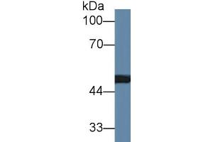 Rabbit Detection antibody from the kit in WB with Positive Control: Rat serum. (MMP13 Kit CLIA)