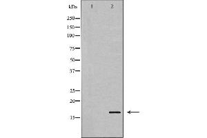 Western blot analysis of Stathmin 1 expression in Jurkat cells. (Stathmin 1 anticorps  (N-Term))