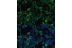 Immunofluorescence analysis of NIH-3T3 cells using EIF1AX Polyclonal Antibody (ABIN6131999, ABIN6140017, ABIN6140018 and ABIN6221620) at dilution of 1:100 (40x lens). (EIF1AX anticorps  (AA 10-144))
