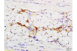 Formalin-fixed and paraffin embedded rat tongue tissue labeled with Anti-CD47/MER6 Polyclonal Antibody, Unconjugated  at 1:200 followed by conjugation to the secondary antibody