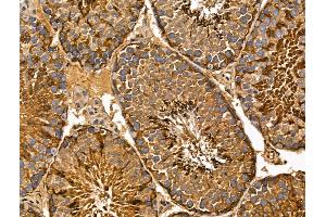 ABIN7094361 and ABIN7098408 at 1/100 staining Mouse testis tissue by IHC-P.