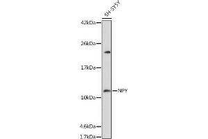Western blot analysis of extracts of SH-SY5Y cells, using NPY antibody (ABIN3017528, ABIN3017529, ABIN3017530 and ABIN6220138) at 1:1000 dilution.