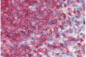 Human Spleen (formalin-fixed, paraffin-embedded) stained with CD44 antibody ABIN396970 at 5 ug/ml followed by biotinylated anti-mouse IgG secondary antibody ABIN481714, alkaline phosphatase-streptavidin and chromogen.