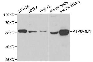 Western blot analysis of extracts of various cell lines, using ATP6V1B1 antibody. (ATP6V1B1 anticorps  (AA 1-280))