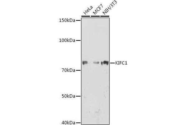 KIFC1 anticorps