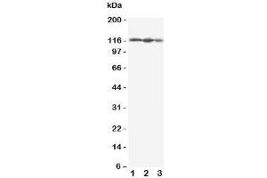 Western blot testing of EIF3B antbody; Lane 1: HeLa;  2: 293T;  3: A431 cell lysate. (EIF3B anticorps  (C-Term))