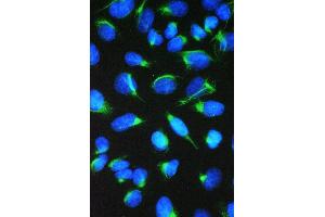 IF analysis of CCT7 using anti-CCT7 antibody (ABIN5692966). (CCT7 anticorps  (AA 30-307))