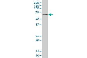 Western Blotting (WB) image for anti-Mitogen-Activated Protein Kinase-Activated Protein Kinase 2 (MAPKAPK2) (AA 266-352) antibody (ABIN598602) (MAPKAP Kinase 2 anticorps  (AA 266-352))