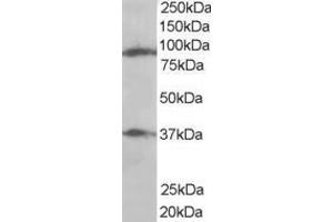 Western Blotting (WB) image for anti-ELKS/RAB6-Interacting/CAST Family Member 1 (ERC1) (N-Term) antibody (ABIN2465645) (ERC1 anticorps  (N-Term))