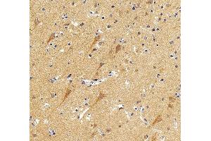 IHC analysis of KCNQ2 using anti-KCNQ2 antibody (ABIN7601522).
