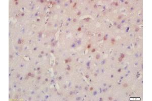 Formalin-fixed and paraffin embedded rat brain labeled with Rabbit Anti-BRD8 Polyclonal Antibody, Unconjugated (ABIN716951) at 1:200 followed by conjugation to the secondary antibody and DAB staining (BRD8 anticorps  (AA 331-430))