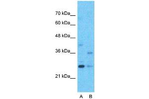 Host:  Rabbit  Target Name:  M96  Sample Type:  Hela  Lane A:  Primary Antibody  Lane B:  Primary Antibody + Blocking Peptide  Primary Antibody Concentration:  1ug/ml  Peptide Concentration:  5ug/ml  Lysate Quantity:  25ug/lane/lane  Gel Concentration:  0. (MTF2 anticorps  (Middle Region))