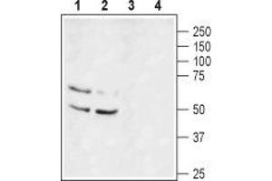 Western blot analysis of rat brain lysate (lanes 1 and 3) and mouse brain lysate (lanes 2 and 4): - 1,2. (KCNA1 anticorps  (1st Extracellular Loop))