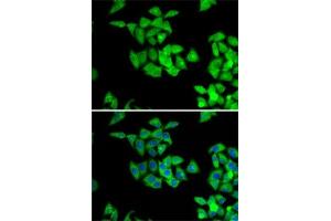 Immunofluorescence analysis of A-549 cells using NMT2 antibody (ABIN6130572, ABIN6144688, ABIN6144690 and ABIN6222825). (NMT2 anticorps  (AA 1-120))
