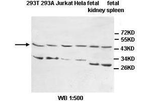 Image no. 1 for anti-Interleukin 1 Receptor, Type II (IL1R2) antibody (ABIN1577241) (IL1R2 anticorps)