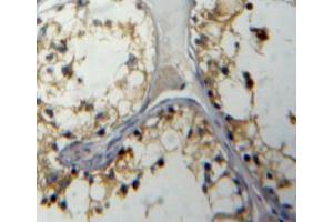 Used in DAB staining on fromalin fixed paraffin-embedded testis tissue (IL5RA anticorps  (AA 42-182))