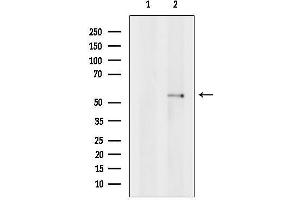 anti-Bestrophin 2 (BEST2) (C-Term) antibody
