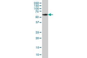 SH3BP5 monoclonal antibody (M01), clone 2B3 Western Blot analysis of SH3BP5 expression in A-431 .