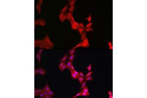 Immunofluorescence analysis of PC-12 cells using Glucocorticoid Receptor Rabbit pAb (ABIN3023090, ABIN3023091, ABIN3023092, ABIN1513281 and ABIN6219384) at dilution of 1:200 (40x lens). (Glucocorticoid Receptor anticorps  (AA 1-280))