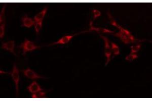 ABIN6274595 staining Hela by IF/ICC. (OB Cadherin anticorps  (Internal Region))