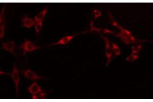 ABIN6274595 staining Hela by IF/ICC.