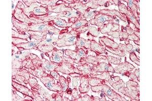 Human Heart: Formalin-Fixed, Paraffin-Embedded (FFPE).