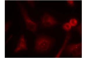 Image no. 1 for anti-SHC (Src Homology 2 Domain Containing) Transforming Protein 1 (SHC1) (Tyr349) antibody (ABIN197588)