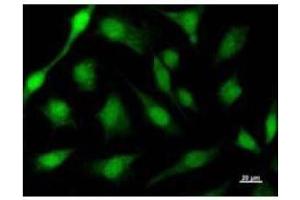 Immunostaining analysis in HeLa cells.