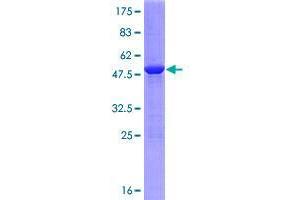 Image no. 1 for Nicotinamide Riboside Kinase 1 (NMRK1) (AA 1-199) protein (GST tag) (ABIN1347736)