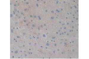 Detection of CCK8 in Human Liver Tissue using Monoclonal Antibody to Cholecystokinin 8 (CCK8) (CCK8 anticorps)