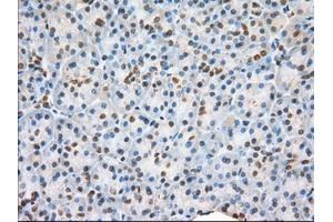 Immunohistochemical staining of paraffin-embedded liver tissue using anti-H6PD mouse monoclonal antibody.