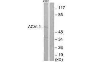 Western blot analysis of extracts from K562 cells, using ACVL1 Antibody. (ACVRL1 anticorps  (AA 196-245))