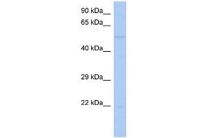 WB Suggested Anti-RIPK3 Antibody Titration:  0. (RIPK3 anticorps  (Middle Region))
