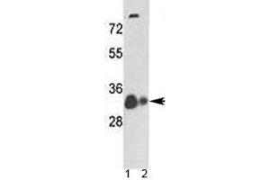 Western blot analysis of VDAC antibody and 1) human A375 cell line and 2) mouse heart tissue lysate. (VDAC1 anticorps  (AA 1-30))