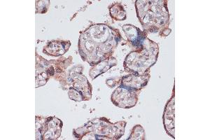 Immunohistochemistry of paraffin-embedded human placenta using RPS13 antibody (ABIN7270012) at dilution of 1:100 (40x lens). (RPS13 anticorps  (AA 79-151))