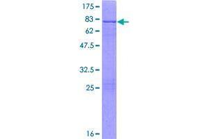 Image no. 1 for Aldehyde Dehydrogenase 8 Family, Member A1 (ALDH8A1) (AA 1-487) protein (GST tag) (ABIN1344845)