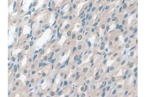 DAB staining on IHC-P; Samples: Rat Stomach Tissue (GSTM4 anticorps  (AA 21-215))