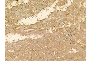 MRS2 Mouse Monoclonal Antibody at 1/100 staining rat heart tissue by IHC-P. (MRS2 anticorps)