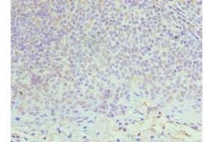 Immunohistochemistry of paraffin-embedded human tonsil tissue using ABIN7150339 at dilution of 1:100 (MCM6 anticorps  (AA 562-821))