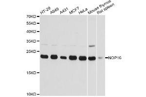 Western blot analysis of extracts of various cell lines, using NOP16 antibody. (NOP16 anticorps)