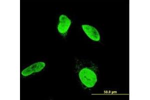 Image no. 3 for anti-Testis-Specific Kinase 2 (TESK2) (AA 405-542) antibody (ABIN599135) (TESK2 anticorps  (AA 405-542))