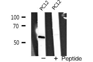 Western blot analysis of TRAF2 expression in PC12 cells (TRAF2 anticorps  (C-Term))