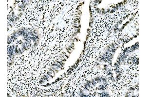 IHC analysis of ADAR1/ADAR using anti-ADAR1/ADAR antibody (ABIN7598956). (ADAR anticorps  (AA 1-1152))