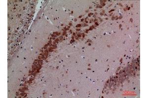 Immunohistochemistry (IHC) analysis of paraffin-embedded Rat Brain, antibody was diluted at 1:100.