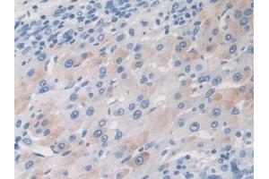 anti-Chemokine (C-C Motif) Ligand 17 (CCL17) (AA 12-83) antibody