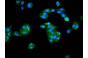 Immunofluorescence staining of PC-3 cells with ABIN7146614 at 1:133, counter-stained with DAPI. (PKIG anticorps  (AA 1-76))